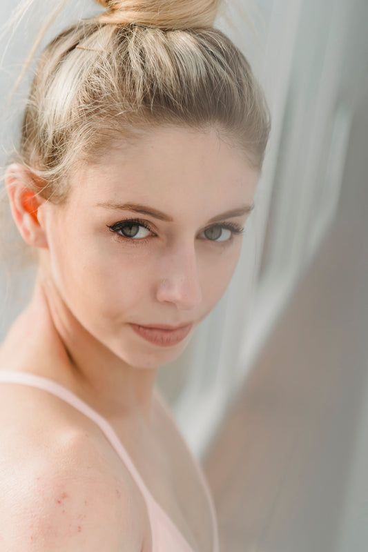 This is a head-and-shoulders picture of a blond-haired young woman with her hair tied up in a top knot. Mild body acne is visible around the shoulder area.